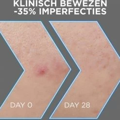 Garnier PureActive AHA + BHA Charcoal Anti-Onzuiverheden Serum - 30ml 12 Garnier PureActive AHA + BHA Charcoal Anti-Onzuiverheden Serum - 30ml -Maybelline-winkel 550x483 3