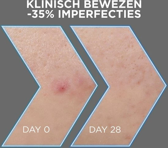 Garnier PureActive AHA + BHA Charcoal Anti-Onzuiverheden Serum - 30ml 5 Garnier PureActive AHA + BHA Charcoal Anti-Onzuiverheden Serum - 30ml - Afbeelding 5