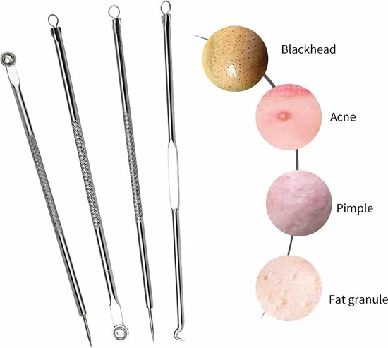 DecoDuoBelle Mee-eters Verwijderen - Blackhead Remover - Puistjes - Professionele Kit - 4 Luxe Puisten Lepels - Mee Eter Lepel - Acne Set - Rose 2 DecoDuoBelle Mee-eters Verwijderen - Blackhead Remover - Puistjes - Professionele Kit - 4 Luxe Puisten Lepels - Mee Eter Lepel - Acne Set - Rose - Afbeelding 2