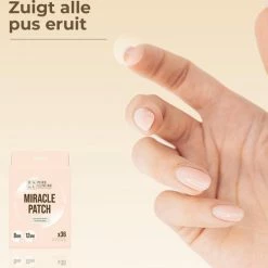 Pure Luxure Pimple Patch 144 ST - Acne Patch - Acne - Acne Pleister - Pimple Patches - Puisten Verwijderaar 13 Pure Luxure Pimple Patch 144 ST - Acne Patch - Acne - Acne Pleister - Pimple Patches - Puisten Verwijderaar -Maybelline-winkel 550x499 3