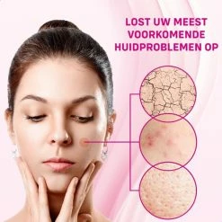 Christian Deluxe® - Pimple Patch 180 Stuks - Acne Patch - Acne - Acne Pleister - Pimple Patches - Puisten Verwijderaar -Maybelline-winkel 550x547 4