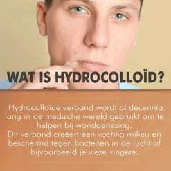 Palm Cosmetics Pimple Patch - Acne Patch - Puisten Verwijderaar - Puisten Pleister - Acne Pleister - Acne Sticker - Puistjes Verwijderen - 108 Stuks -Maybelline-winkel 550x550 1185