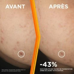 Garnier SkinActive Vitamine C* Anti-Pigmentvlekken Serum - Met Niacinamide En Salicylzuur - Serum Tegen Pigmentvlekken - Voor Een Stralende Huid - 30ml -Maybelline-winkel 550x550 33