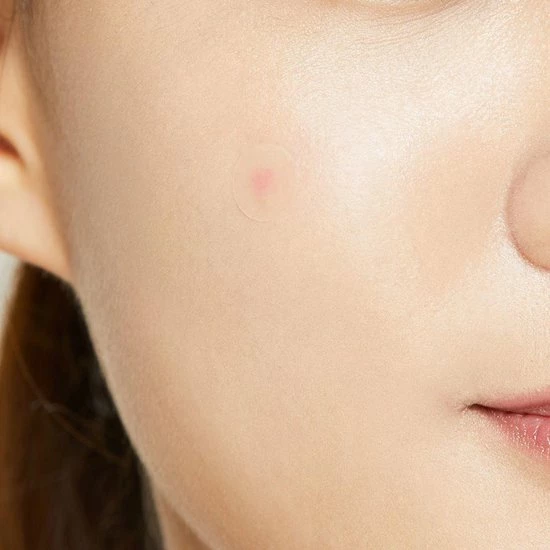 Merkloos COSRX Acne Pimple Master Package Set 4 Packs Of 24 Patches 5 Merkloos COSRX Acne Pimple Master Package Set 4 Packs Of 24 Patches - Afbeelding 5