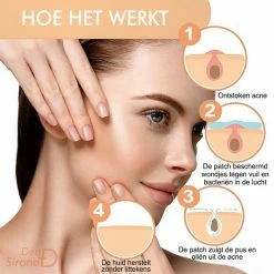 Dea Sirona Pimple Patch - Acne Patch - Puisten Verwijderaar - Puisten Pleister - Acne Pleister - Acne Sticker - Puistjes Verwijderen - 216 Stuks -Maybelline-winkel 550x550 428