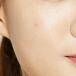 COSRX Acne Pimple Master -Maybelline-winkel 550x550 642