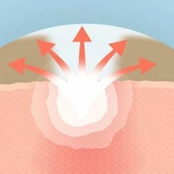 COSRX Acne Pimple Master -Maybelline-winkel 550x550 644