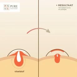 Pure Luxure Pimple Patch 144 ST - Acne Patch - Acne - Acne Pleister - Pimple Patches - Puisten Verwijderaar 15 Pure Luxure Pimple Patch 144 ST - Acne Patch - Acne - Acne Pleister - Pimple Patches - Puisten Verwijderaar -Maybelline-winkel 550x550 720