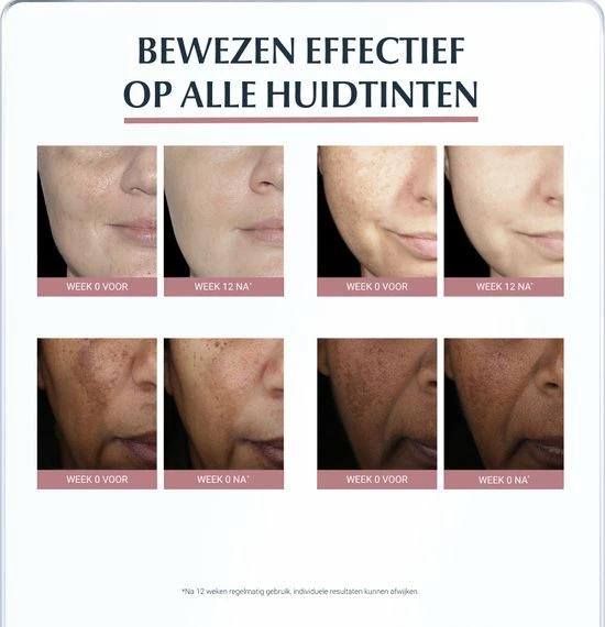 Eucerin Anti-Pigment Dagcr Me SPF30 - Dagcr Me - 50 Ml 5 Eucerin Anti-Pigment Dagcr Me SPF30 - Dagcr Me - 50 Ml - Afbeelding 5